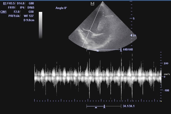 ЭХО сердца при выявленном шуме у кошки