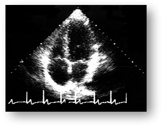 Эхокардиография у собаки без явных симптомов