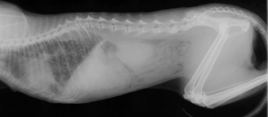 Исключение пневмонии