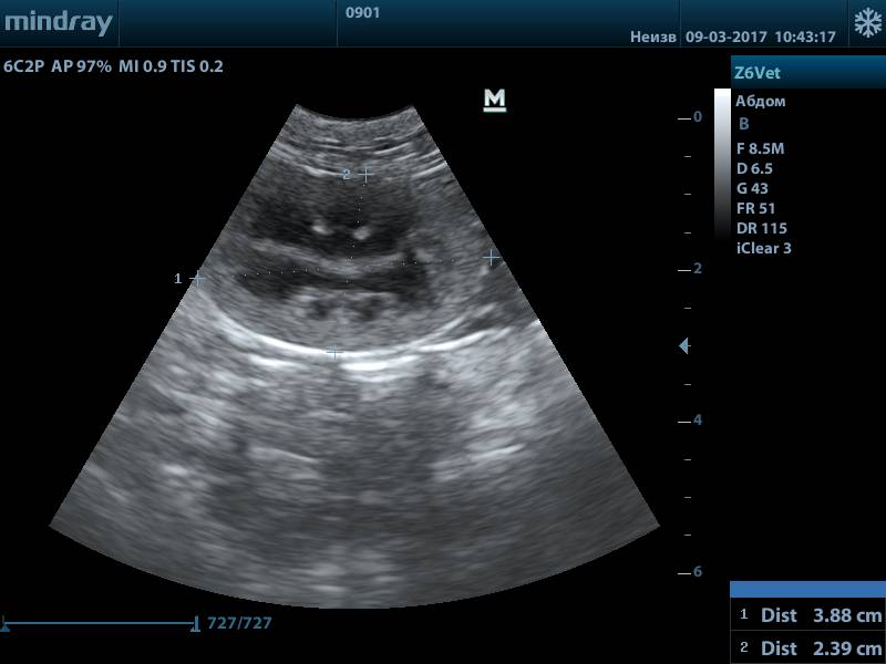 Оценка паренхимы при подозрении на нефропатию