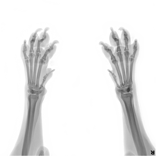 Оценка опорно-двигательного аппарата