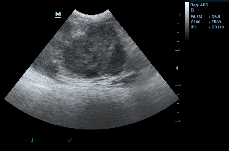Диагностика гастрита